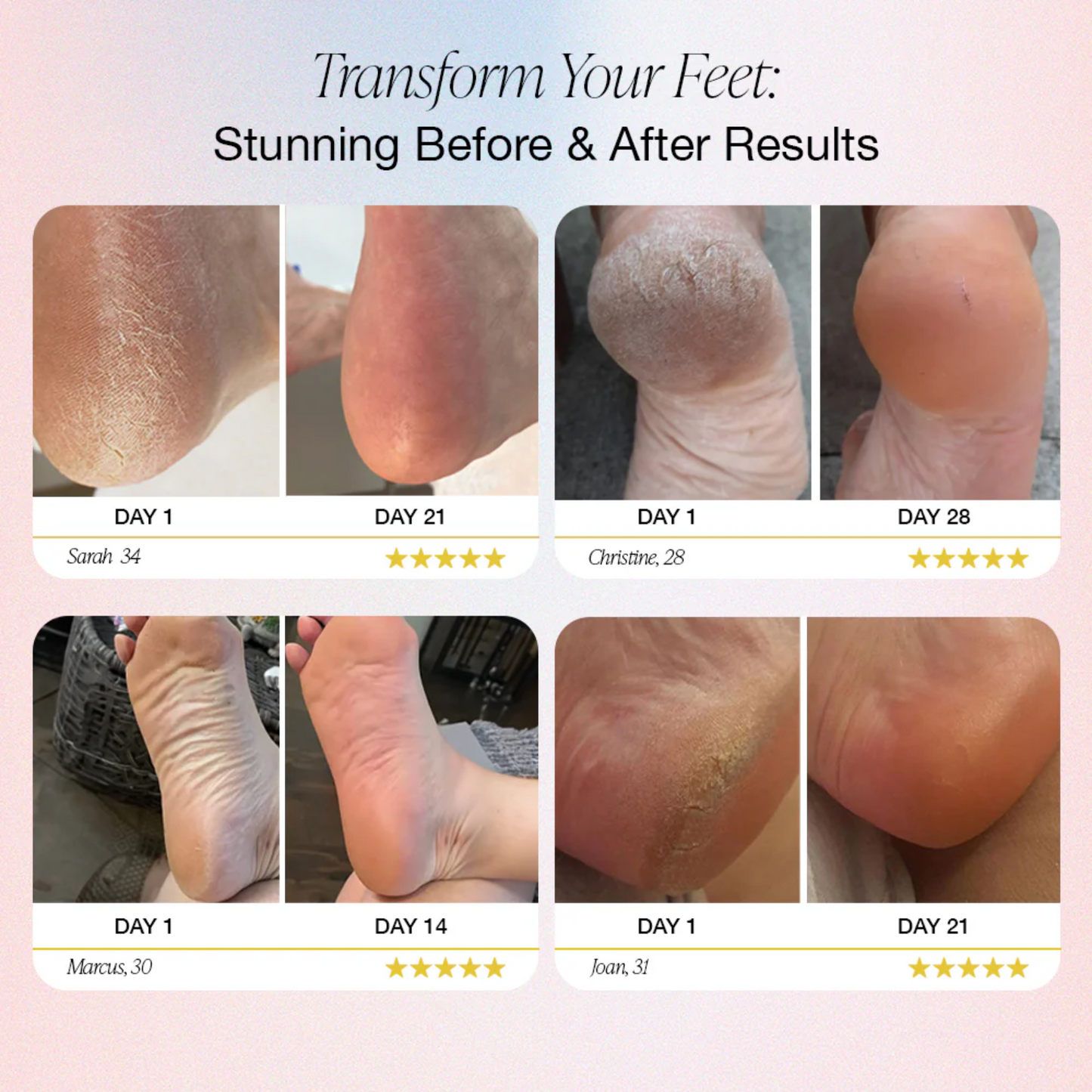 Permave™ Electric Foot Callus Remover